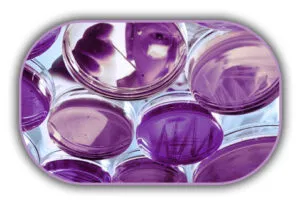 Salmonella Spp Aranması